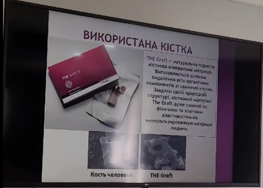 КАФЕДРА СТОМАТОЛОГІЇ ПІСЛЯДИПЛОМНОЇ ОСВІТИ Стоматологічний ф-т ДВНЗ "УжНУ" КАФЕДРА СТОМАТОЛОГІЇ ПІСЛЯДИПЛОМНОЇ ОСВІТИ Стоматологічний ф-т ДВНЗ "УжНУ"