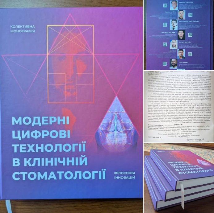 КАФЕДРА СТОМАТОЛОГІЇ ПІСЛЯДИПЛОМНОЇ ОСВІТИ Стоматологічний ф-т ДВНЗ "УжНУ" КАФЕДРА СТОМАТОЛОГІЇ ПІСЛЯДИПЛОМНОЇ ОСВІТИ Стоматологічний ф-т ДВНЗ "УжНУ"